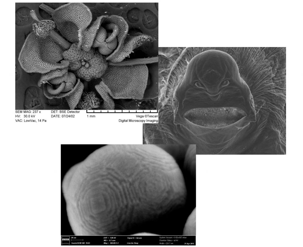 Scoprire l'invisibile: l'arte della microscopia elettronica - Telethon